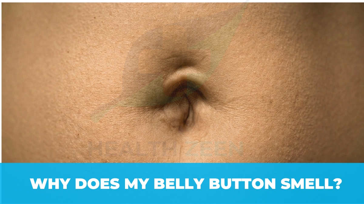 Close-up of an adult umbilicus showing deep anatomical skin folds that can trap bacteria and cause navel odo