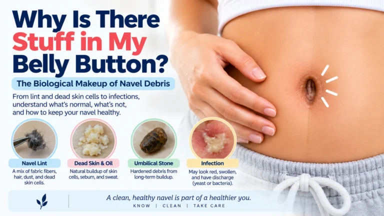 A clinical guide explaining the biological makeup of navel debris to answer why there is stuff in the belly button. The image features a person's abdomen and highlights four types of buildup: navel lint made of fabric fibers and hair, dead skin and oil from natural buildup, an umbilical stone caused by hardened long-term debris, and an infection showing redness, swelling, and discharge.