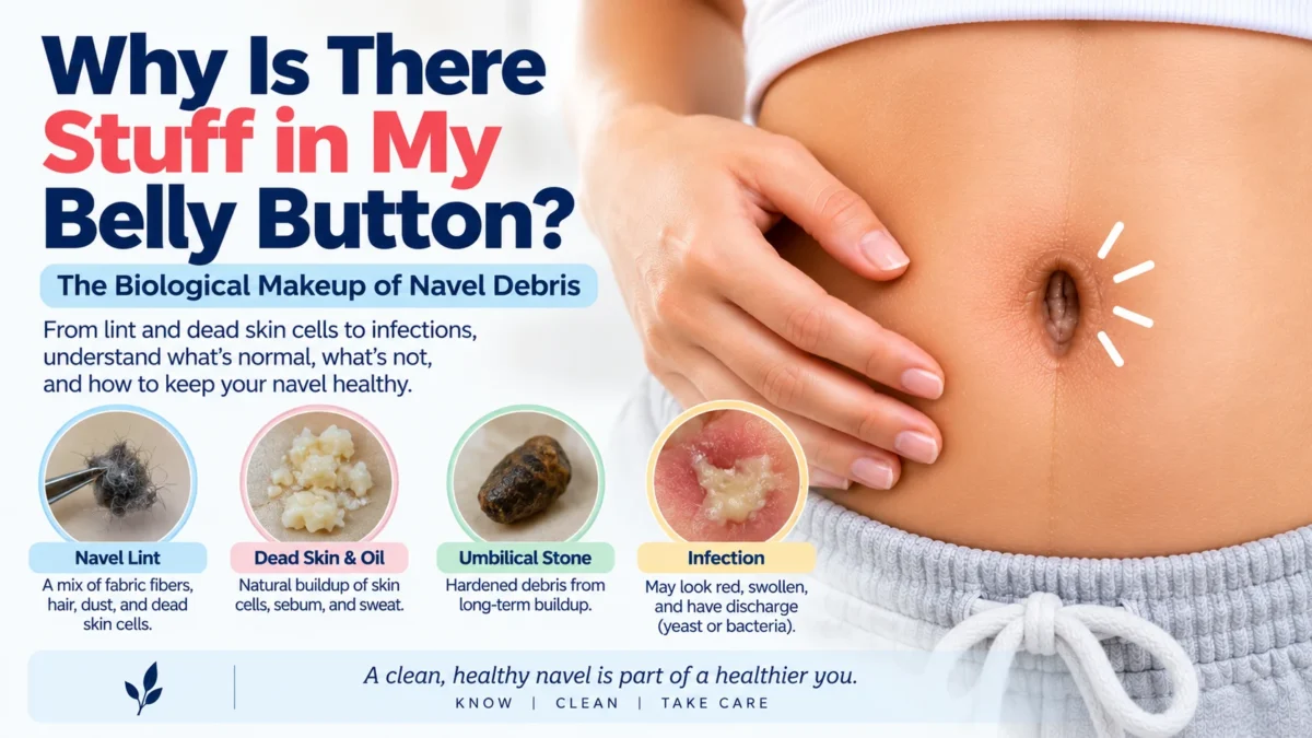 A clinical guide explaining the biological makeup of navel debris to answer why there is stuff in the belly button. The image features a person's abdomen and highlights four types of buildup: navel lint made of fabric fibers and hair, dead skin and oil from natural buildup, an umbilical stone caused by hardened long-term debris, and an infection showing redness, swelling, and discharge.